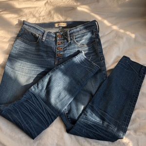 Madewell botton fly jeans 9” high riser skinny